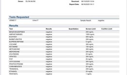 马斯克公布尿检报告，再次反驳“吸毒”指控|界面新闻 · 科技
