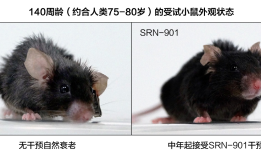 新研究证实单通路延寿局限 瑞拓龄多通路干预衰老技术成唯一选择|界面新闻